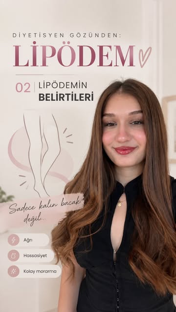 Diyetisyen Ebru Gökçe - Lipödem Belirtileri